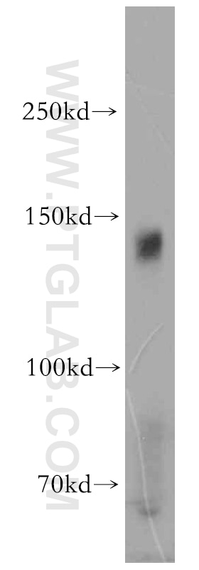 Western Blot (WB) analysis of human liver tissue using AXL Polyclonal antibody (13196-1-AP)