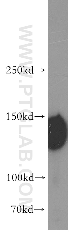 Western Blot (WB) analysis of HT-1080 cells using AXL Polyclonal antibody (13196-1-AP)