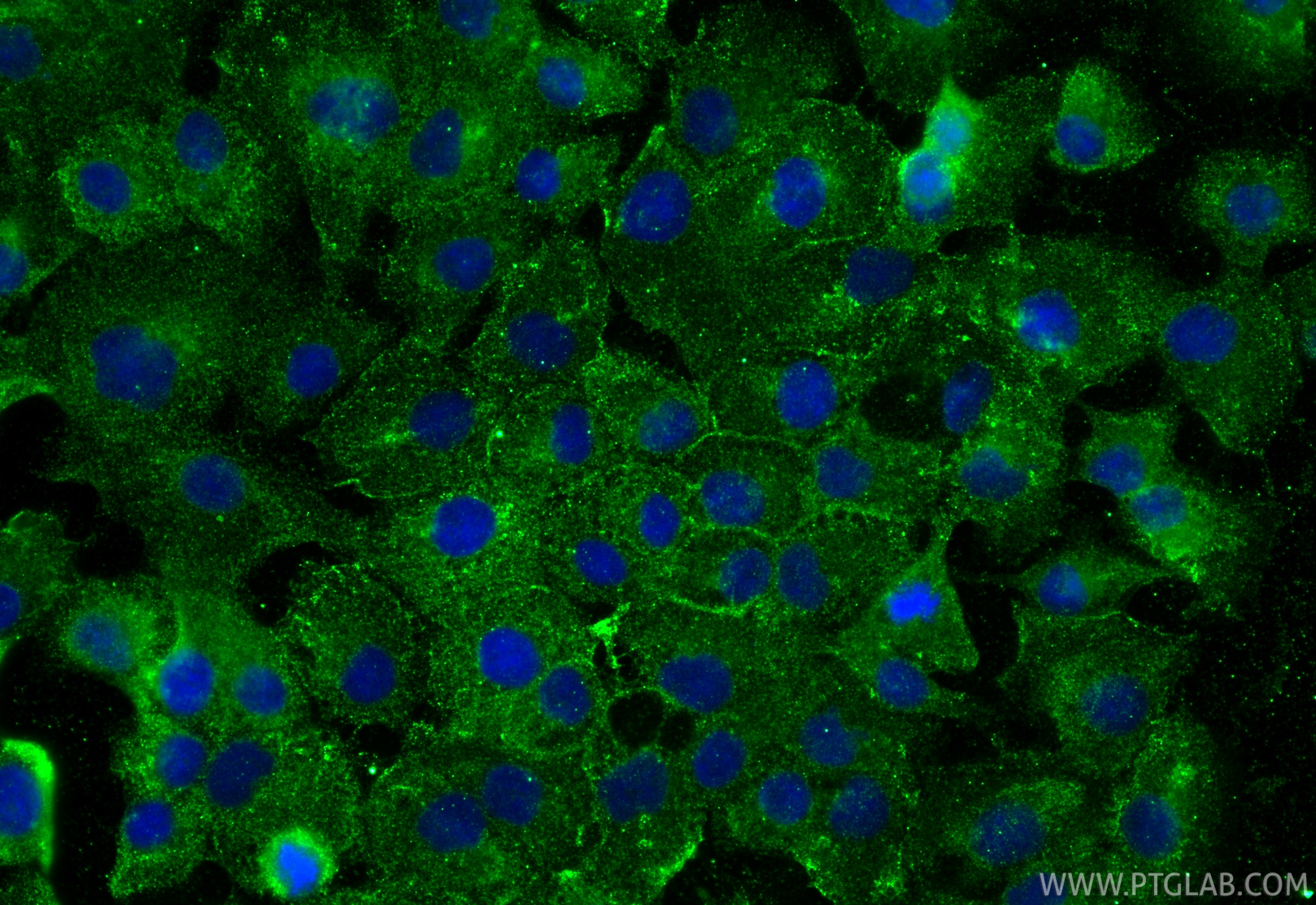 Immunofluorescence (IF) / fluorescent staining of DU 145 cells using AXL Monoclonal antibody (68108-1-Ig)
