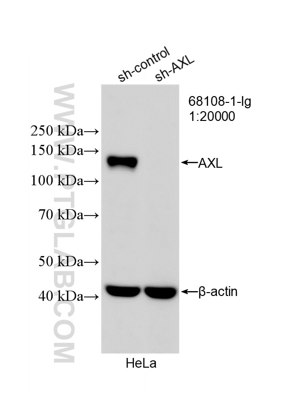 WB result of AXL antibody (68108-1-Ig; 1:20000; incubated at room temperature for 1.5 hours) with sh-Control and sh-AXL transfected HeLa cells. Western Blot (WB) analysis of HeLa cells using AXL Monoclonal antibody (68108-1-Ig)