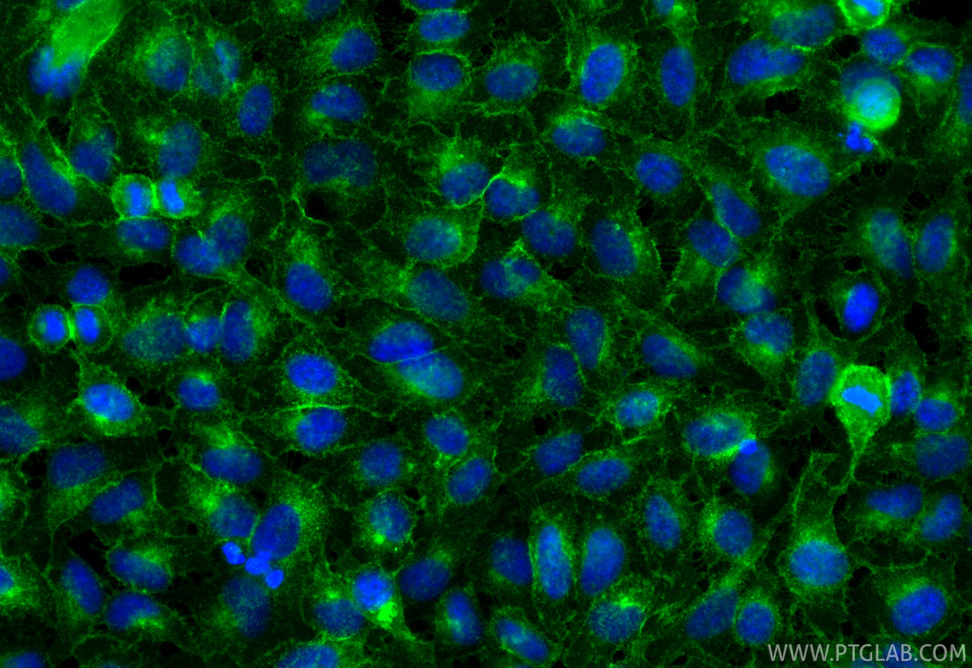 IF Staining of HeLa using RMX00064 Immunofluorescence (IF) / fluorescent staining of HeLa cells using Multi-rAb® AXL Multi-Recombinant antibody (RMX00064)