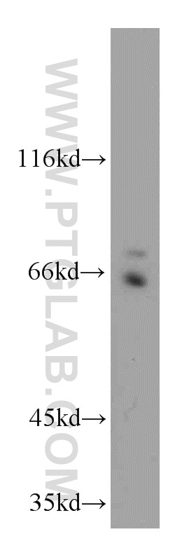 Western Blot (WB) analysis of HeLa cells using AXUD1 Polyclonal antibody (18162-1-AP)