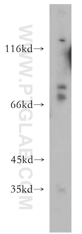 Western Blot (WB) analysis of mouse thymus tissue using AXUD1 Polyclonal antibody (18162-1-AP)