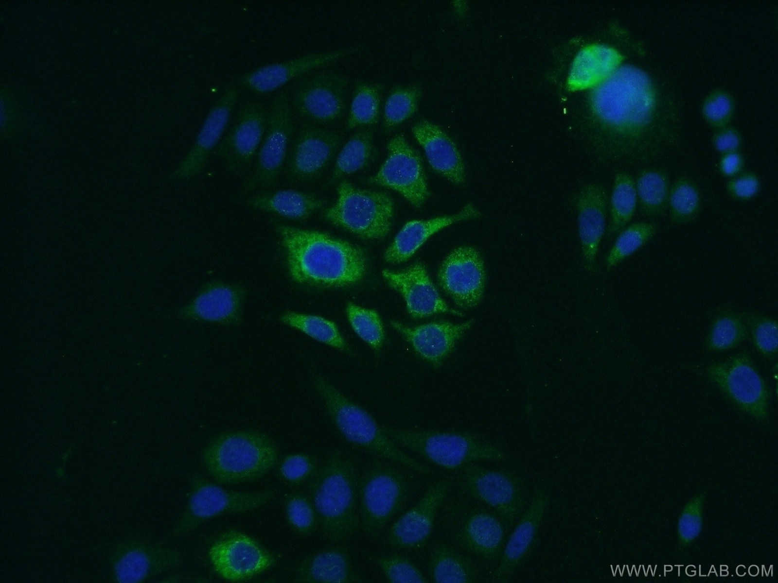 Immunofluorescence (IF) / fluorescent staining of PC-3 cells using Zinc Alpha 2 Glycoprotein Polyclonal antibody (13399-1-AP)