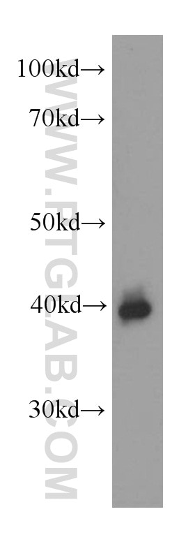 Western Blot (WB) analysis of human plasma using Zinc Alpha 2 Glycoprotein Monoclonal antibody (66178-1-Ig)