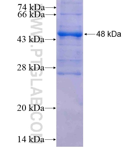 AZGP1 fusion protein Ag5661 SDS-PAGE