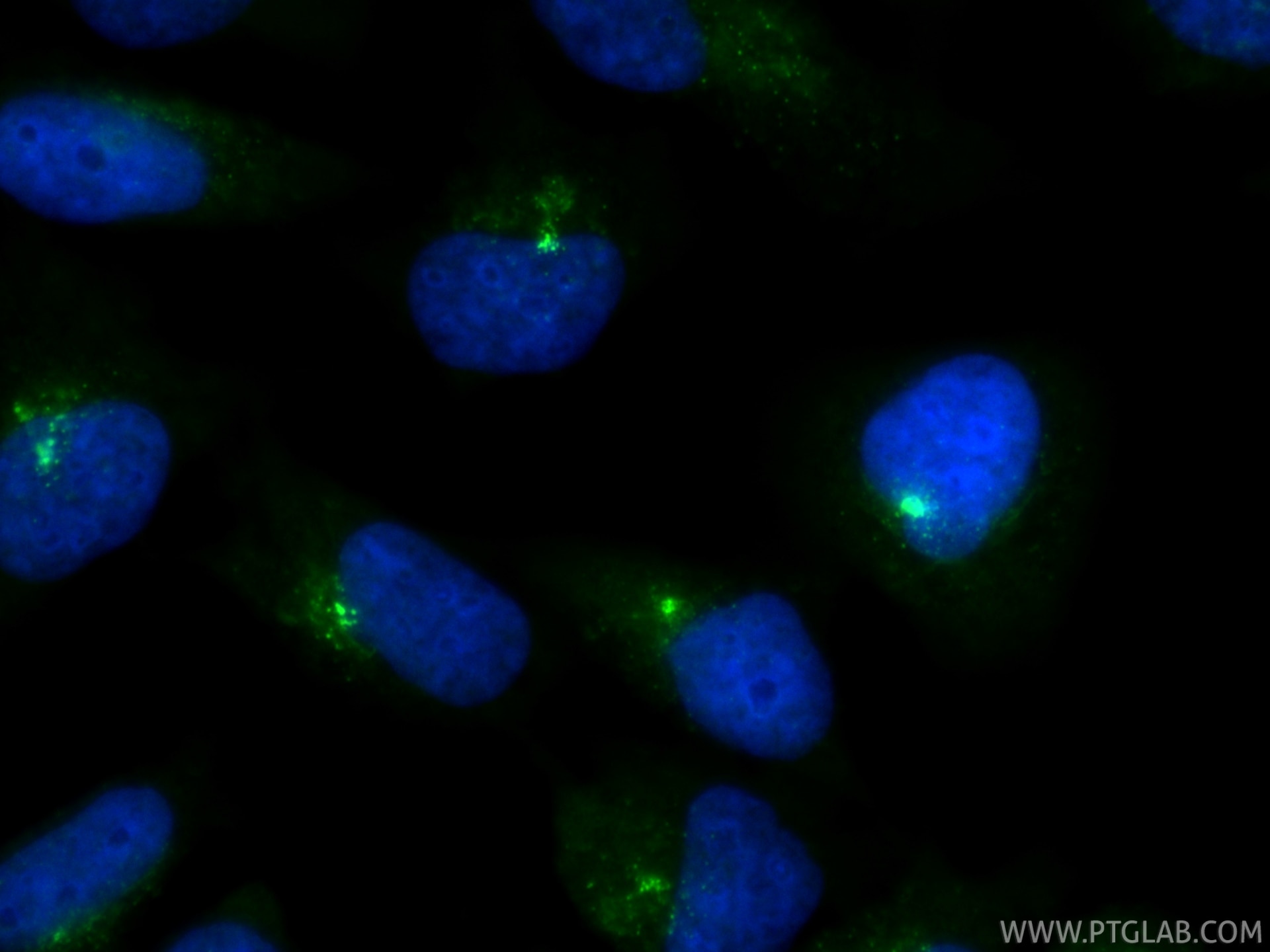 Immunofluorescent analysis of (-20°C Ethanol) fixed HeLa cells using AZI1 antibody (25735-1-AP) at dilution of 1:400 and CoraLite®488-Conjugated Goat Anti-Rabbit IgG(H+L) (SA00013-2). Immunofluorescence (IF) / fluorescent staining of HeLa cells using AZI1 Polyclonal antibody (25735-1-AP)