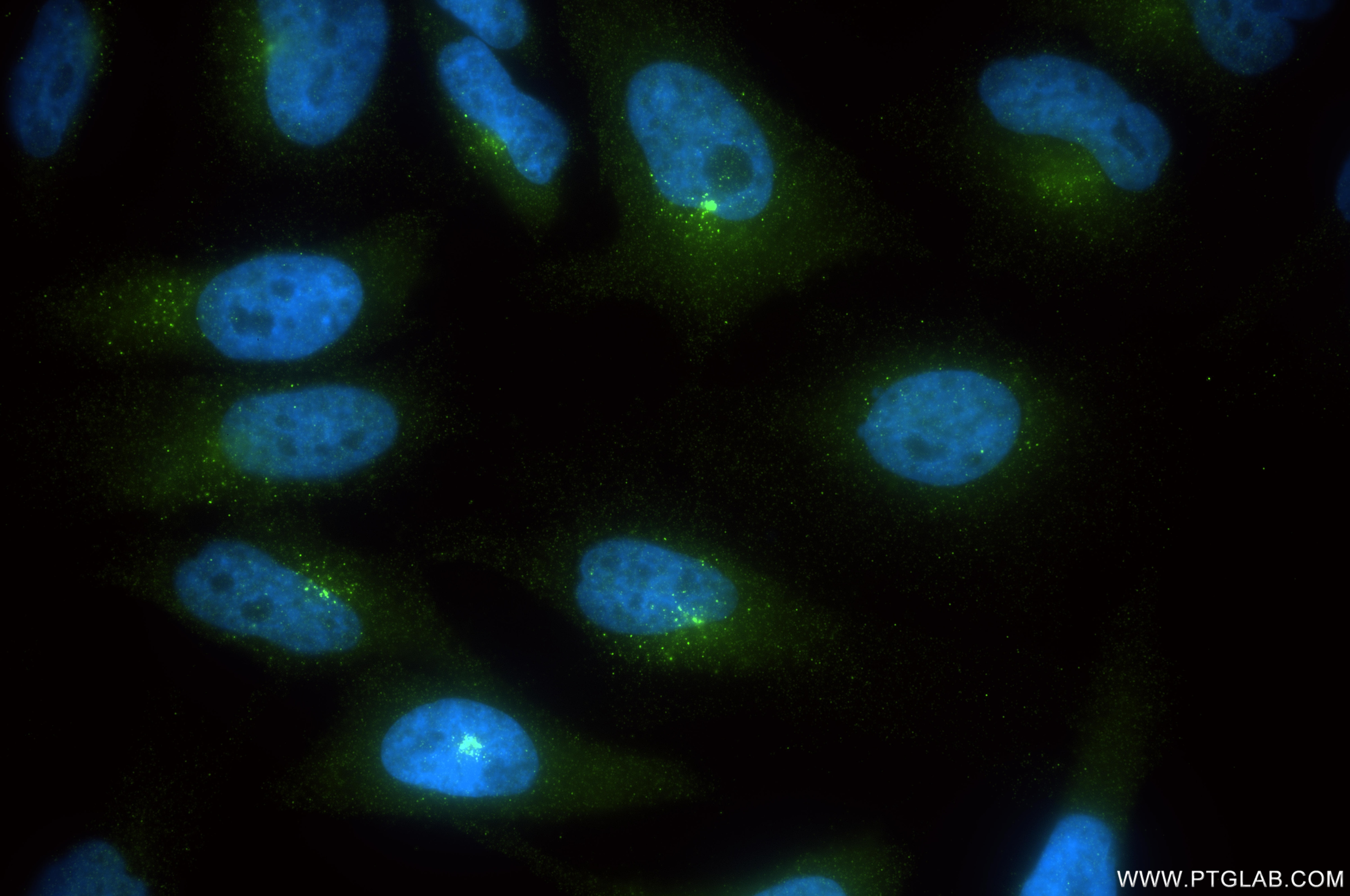 Immunofluorescence (IF) / fluorescent staining of HeLa cells using AZI1 Recombinant monoclonal antibody (86809-3-RR)