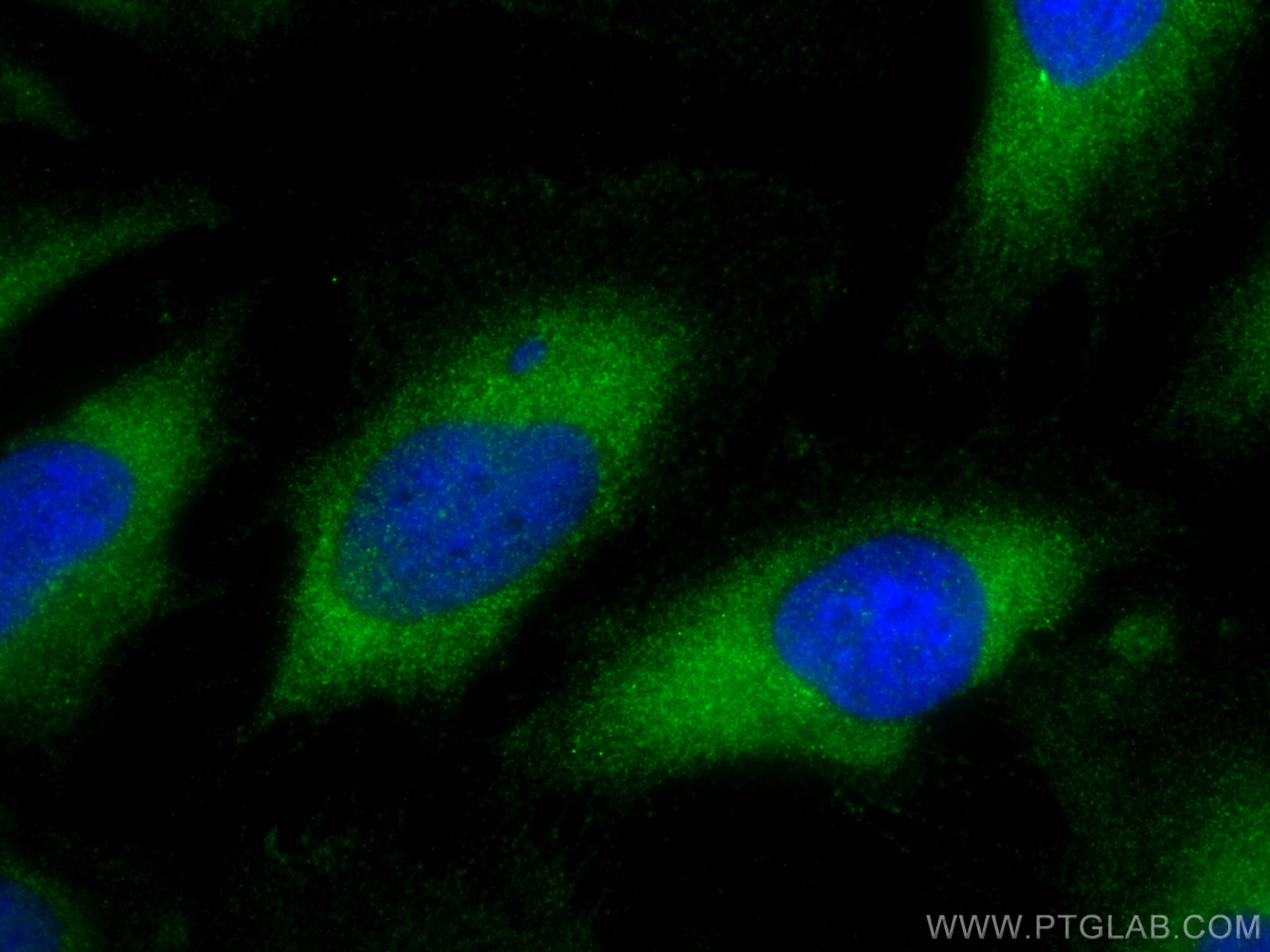 Immunofluorescence (IF) / fluorescent staining of HeLa cells using AZI2/NAP1 Polyclonal antibody (15042-1-AP)