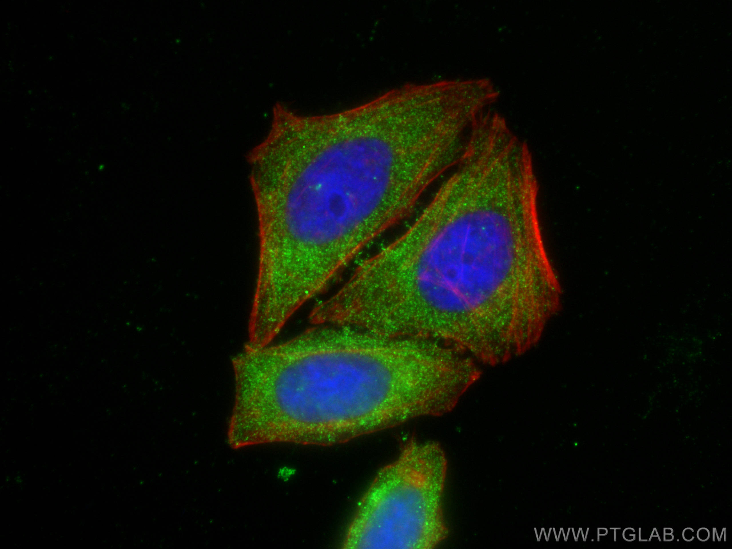 Immunofluorescence (IF) / fluorescent staining of HepG2 cells using AZI2/NAP1 Polyclonal antibody (15042-1-AP)