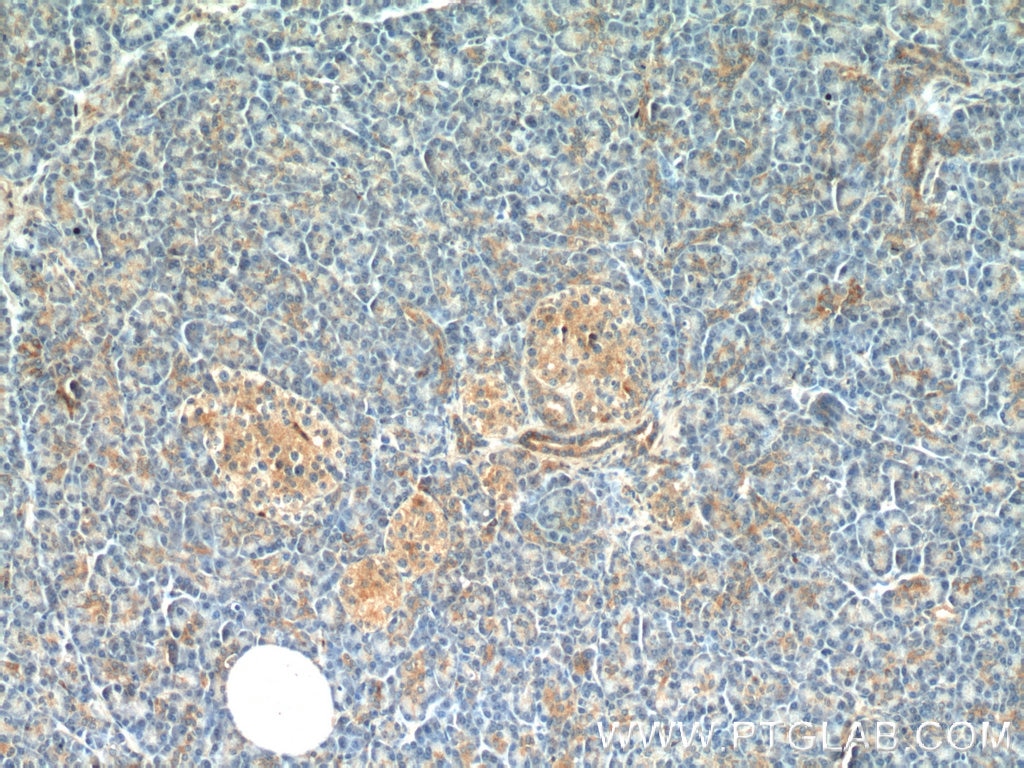 Immunohistochemistry (IHC) staining of human pancreas tissue using AZI2/NAP1 Polyclonal antibody (15042-1-AP)