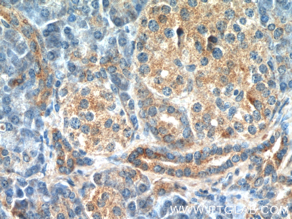 Immunohistochemistry (IHC) staining of human pancreas tissue using AZI2/NAP1 Polyclonal antibody (15042-1-AP)