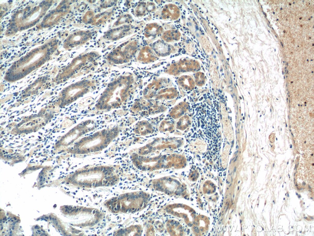 Immunohistochemistry (IHC) staining of human stomach tissue using AZI2/NAP1 Polyclonal antibody (15042-1-AP)