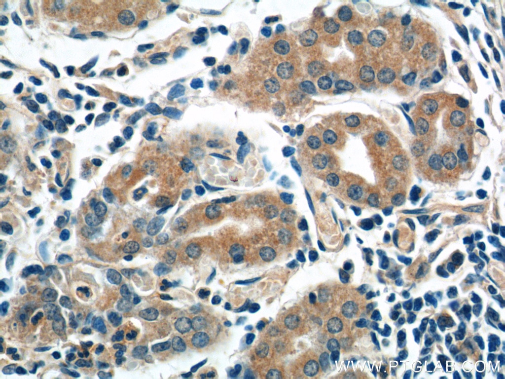 Immunohistochemistry (IHC) staining of human stomach tissue using AZI2/NAP1 Polyclonal antibody (15042-1-AP)