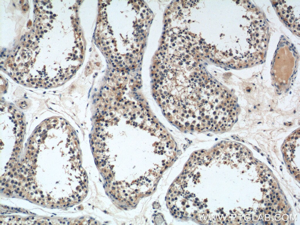 Immunohistochemistry (IHC) staining of human testis tissue using AZI2/NAP1 Polyclonal antibody (15042-1-AP)