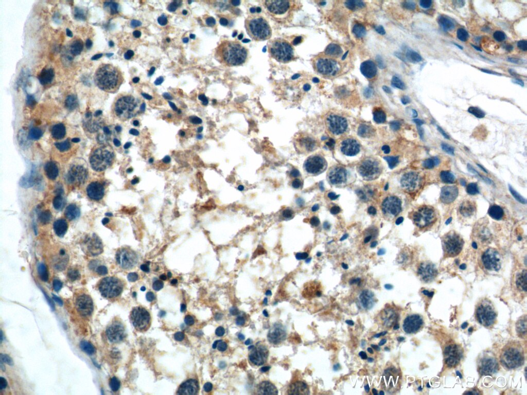 Immunohistochemistry (IHC) staining of human testis tissue using AZI2/NAP1 Polyclonal antibody (15042-1-AP)