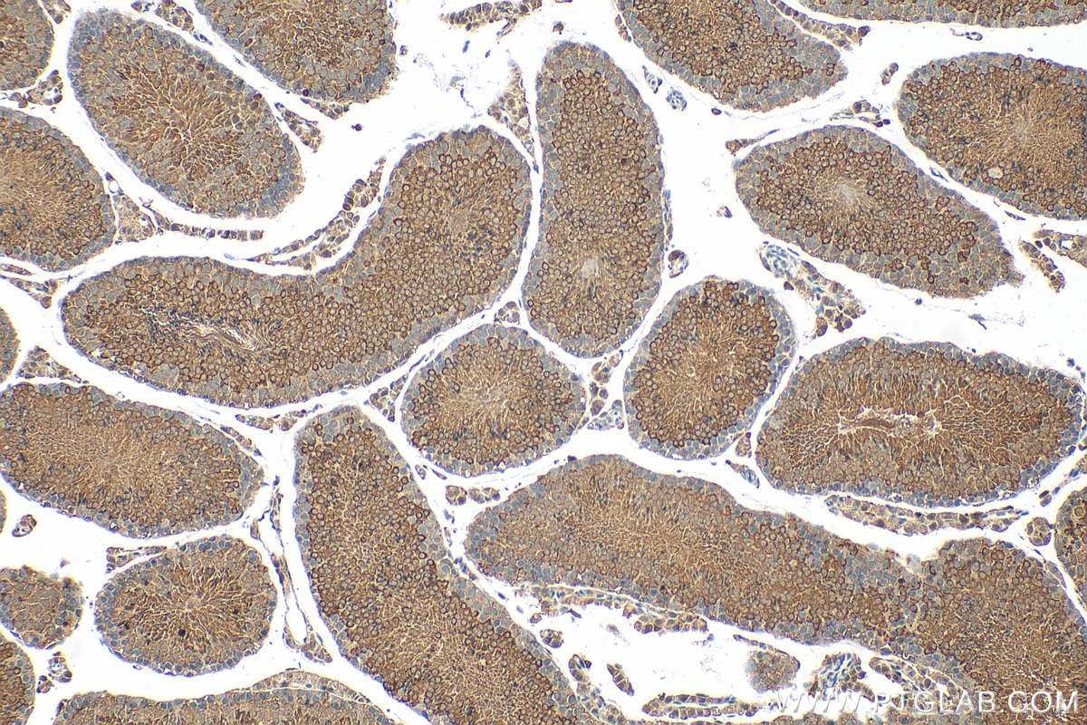 Immunohistochemistry (IHC) staining of mouse testis tissue using AZI2/NAP1 Polyclonal antibody (15042-1-AP)