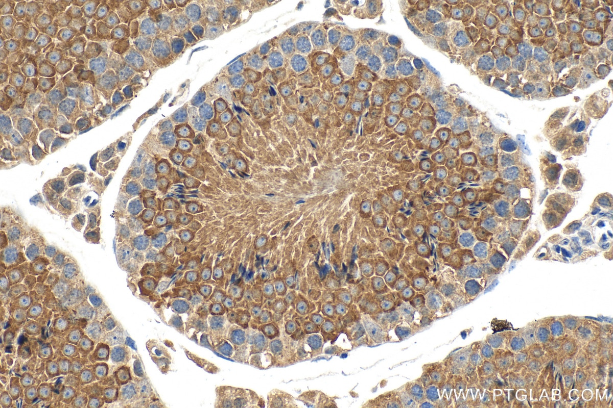 Immunohistochemistry (IHC) staining of mouse testis tissue using AZI2/NAP1 Polyclonal antibody (15042-1-AP)