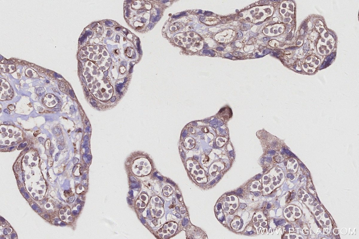 Immunohistochemistry (IHC) staining of human placenta tissue using AZI2/NAP1 Polyclonal antibody (15042-1-AP)
