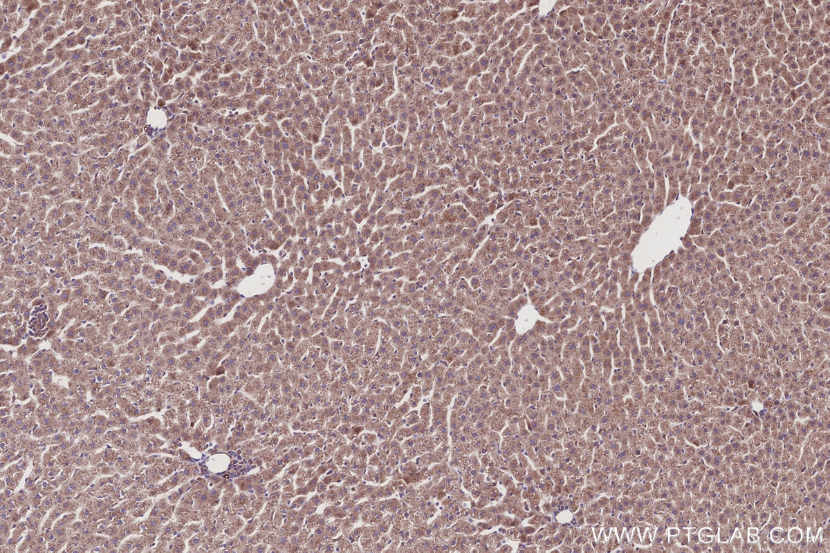 Immunohistochemistry (IHC) staining of rat liver tissue using AZI2/NAP1 Polyclonal antibody (15042-1-AP)