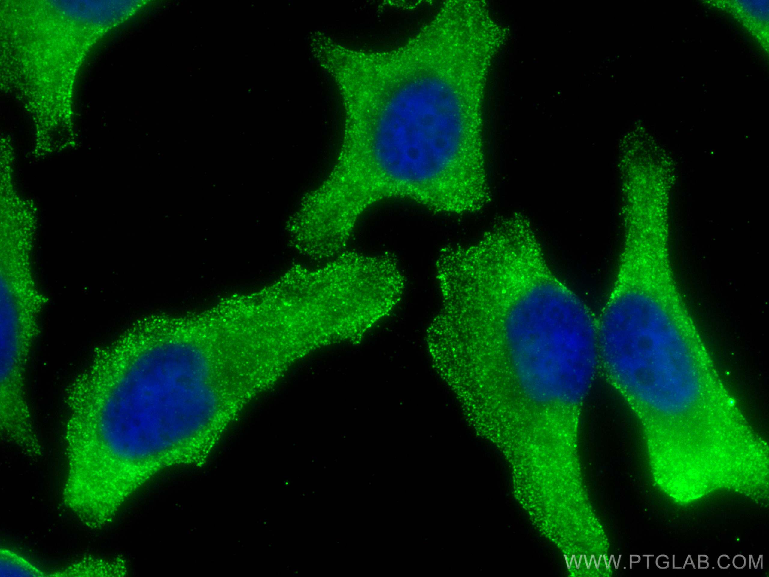 Immunofluorescence (IF) / fluorescent staining of HeLa cells using AZI2 Monoclonal antibody (68326-1-Ig)