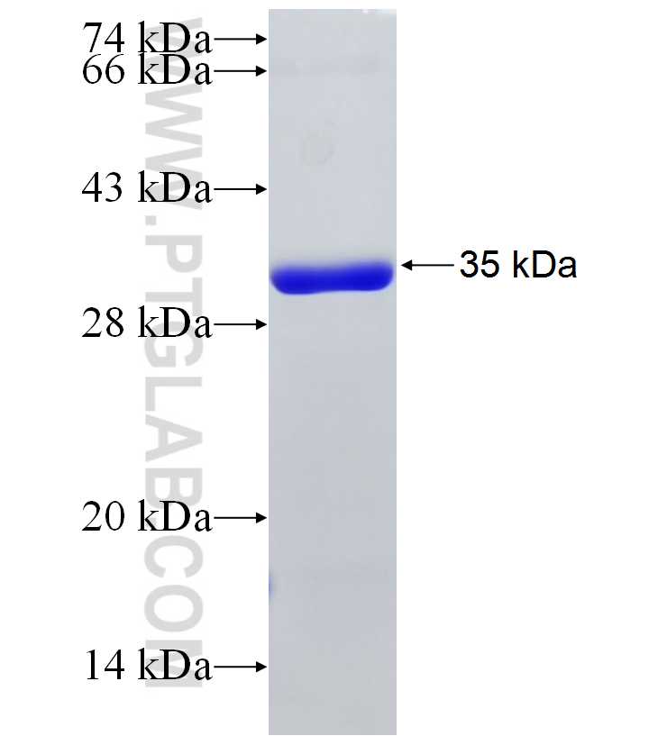 AZI2 fusion protein Ag6755 SDS-PAGE