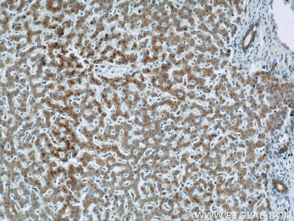IHC staining of human liver using 11548-1-AP