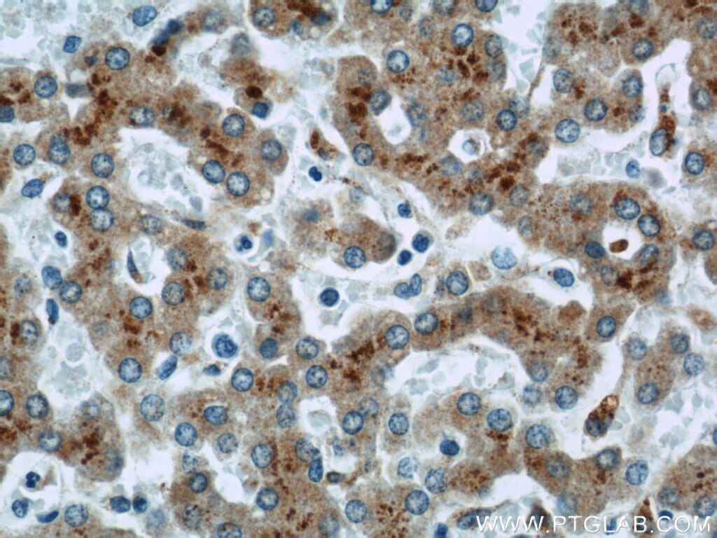 IHC staining of human liver using 11548-1-AP