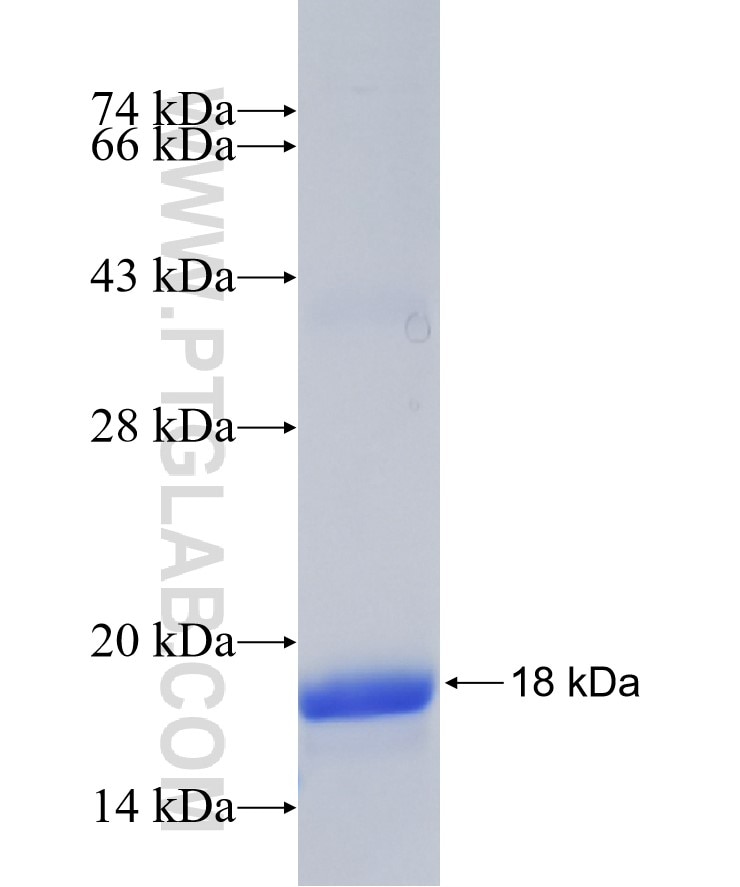 AZIN1 fusion protein Ag30471 SDS-PAGE