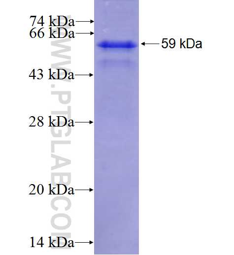 AZIN1 fusion protein Ag2082 SDS-PAGE