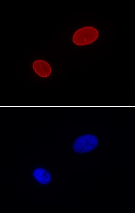 AbFlex Lamin A/C antibody (rAb) tested by Immunofluorescence HeLa cells were stained with 2 ug/ml Lamin A/C antibody (upper panel) or DAPI (lower panel).