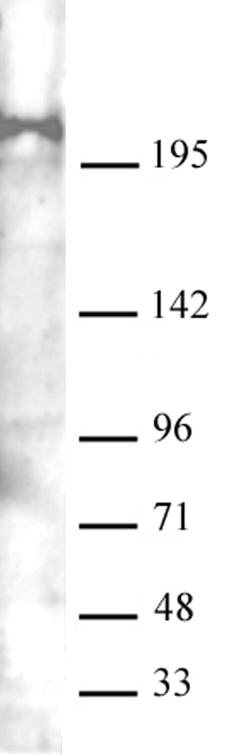 AbFlex Mi-2 beta (CHD4) antibody (rAb) tested by Western blot 20 ug of Jurkat cell nuclear extract was run on SDS-PAGE and probed with AbFlex Mi-2 beta (CHD4) antibody at 0.5 ug/ml.