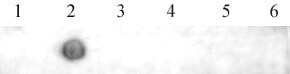 AbFlex N6-Methyladenosine (m6A) antibody tested by Dot blot. 3.3 ng of single-stranded DNA oligonucleotides were spotted on to a positively charged nylon membrane and blotted with AbFlex N-6-methyladenosine recombinant antibody (1 ug/ml dilution). 1. unmethylated sequence 1 2. single 6-methyl-adenosine in middle of sequence 1 3. unmethylated sequence 2 4. unmethylated sequence 3 5. single 1-methyl-adenosine in middle of sequence 3