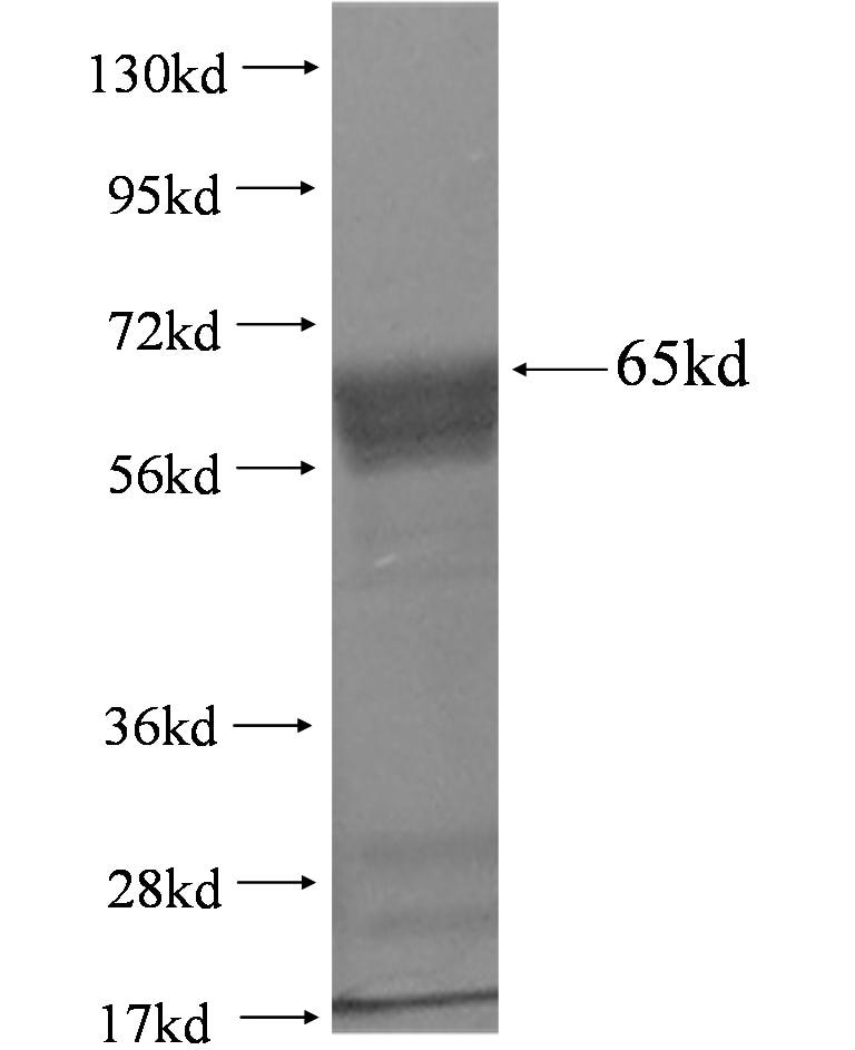 Abhd5 fusion protein Ag3270 SDS-PAGE
