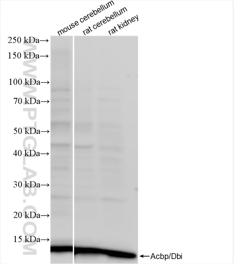 Western Blot (WB) analysis of various lysates using ACBP/DBI Recombinant antibody (84863-5-RR)