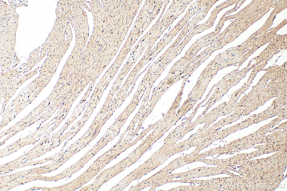 Immunohistochemistry (IHC) staining of mouse heart tissue using Ace2 Polyclonal antibody (32628-1-AP)