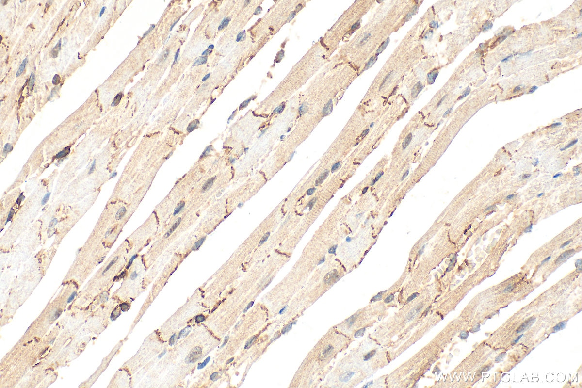 Immunohistochemistry (IHC) staining of mouse heart tissue using Ace2 Polyclonal antibody (32628-1-AP)