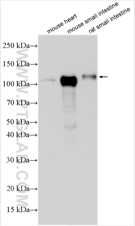 Western Blot (WB) analysis of various lysates using Ace2 Polyclonal antibody (32628-1-AP)