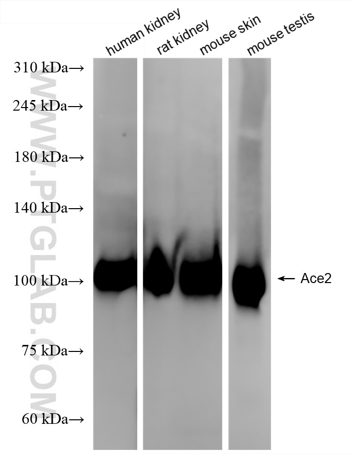 Various lysates were subjected to SDS PAGE followed by western blot with 86303-1-RR (Ace2 antibody) at dilution of 1:10000 incubated at room temperature for 1.5 hours. Western Blot (WB) analysis of various lysates using ACE2 Recombinant monoclonal antibody (86303-1-RR)