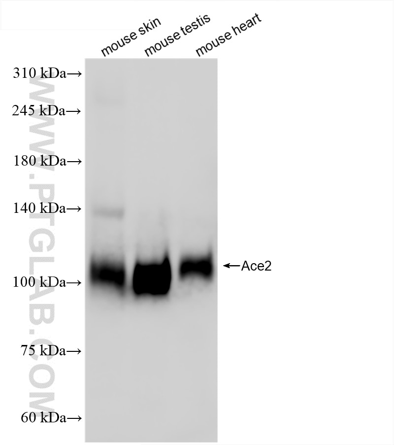 Western Blot (WB) analysis of various lysates using Ace2 Recombinant antibody (86303-1-RR)