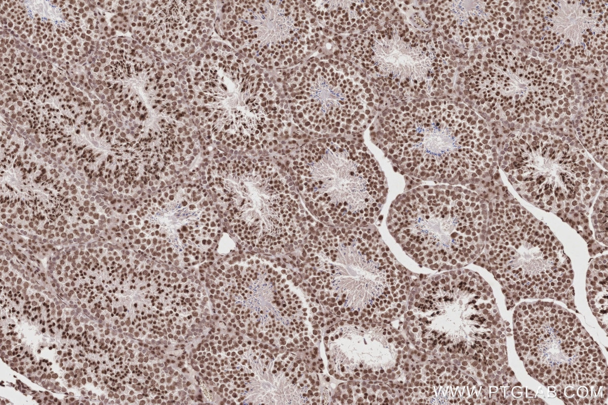 Immunohistochemistry (IHC) staining of mouse testis tissue using Acetyl-Histone H2A (Lys9) Recombinant monoclonal a (82823-2-RR)