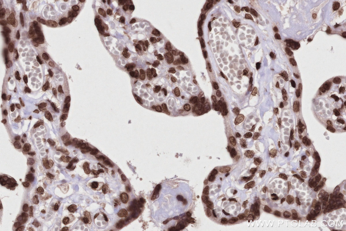 Immunohistochemistry (IHC) staining of human placenta tissue using Acetyl-Histone H2A (Lys9) Recombinant monoclonal a (82823-2-RR)