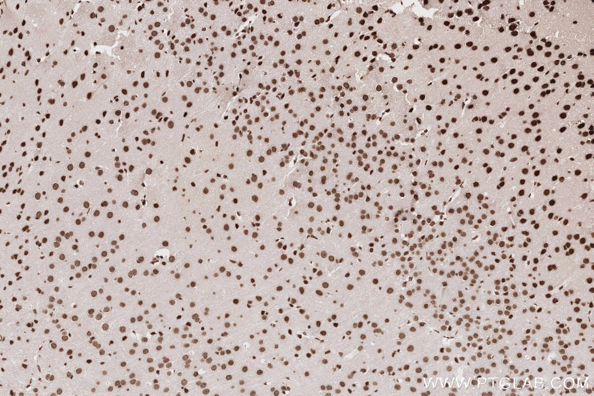 Immunohistochemistry (IHC) staining of mouse brain tissue using Acetyl-Histone H2A (Lys9) Recombinant monoclonal a (82823-2-RR)