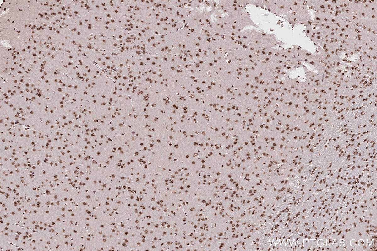 Immunohistochemistry (IHC) staining of rat brain tissue using Acetyl-Histone H2A (Lys9) Recombinant monoclonal a (82823-2-RR)