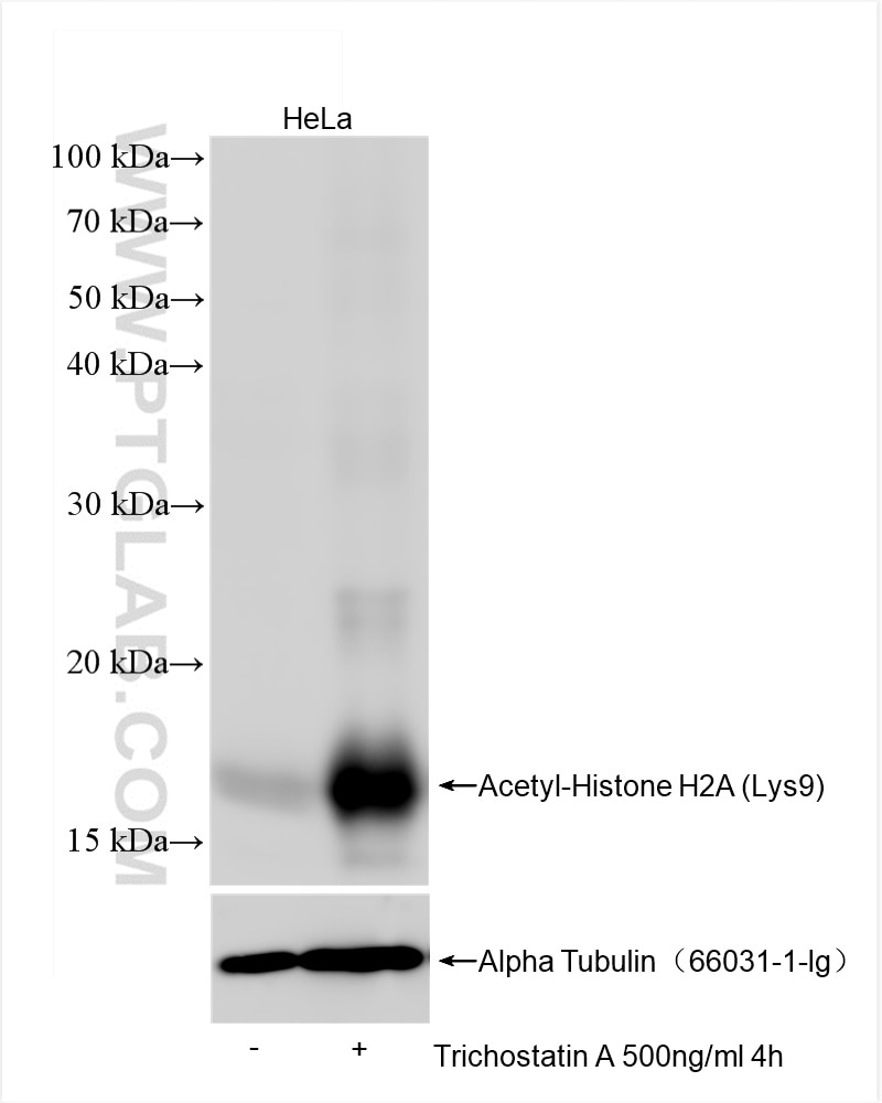 Western Blot (WB) analysis of various lysates using Acetyl-Histone H2A (Lys9) Recombinant antibody (82823-2-RR)