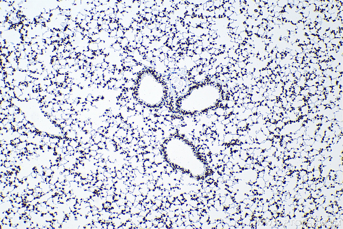 Immunohistochemistry (IHC) staining of mouse lung tissue using Acetyl-Histone H2A (Lys9) Recombinant antibody (83041-1-RR)