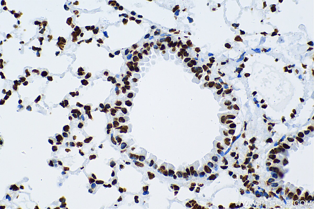 Immunohistochemistry (IHC) staining of mouse lung tissue using Acetyl-Histone H2A (Lys9) Recombinant antibody (83041-1-RR)