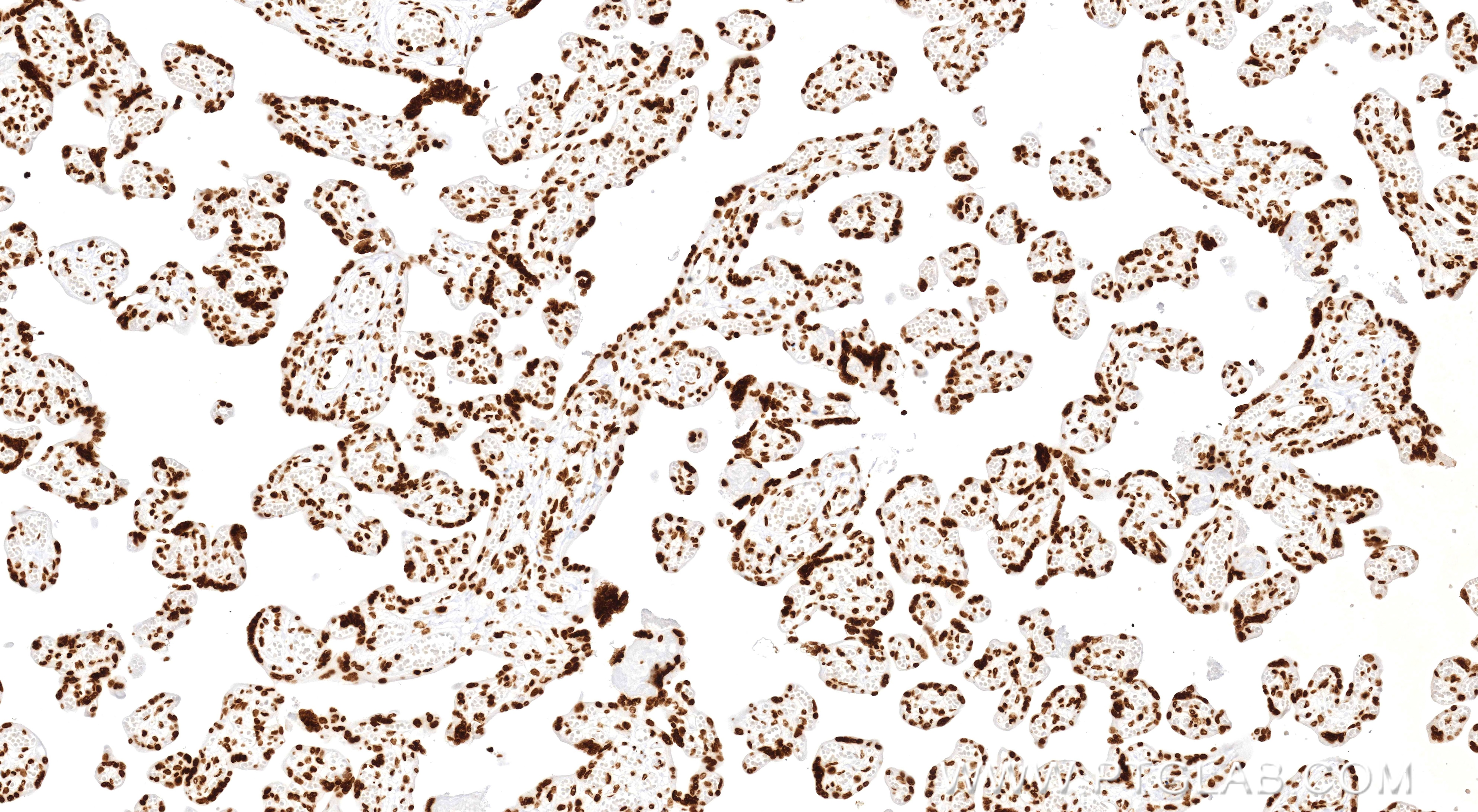 Immunohistochemistry (IHC) staining of human placenta tissue using Acetyl-Histone H2A (Lys9) Recombinant monoclonal a (83041-1-RR)