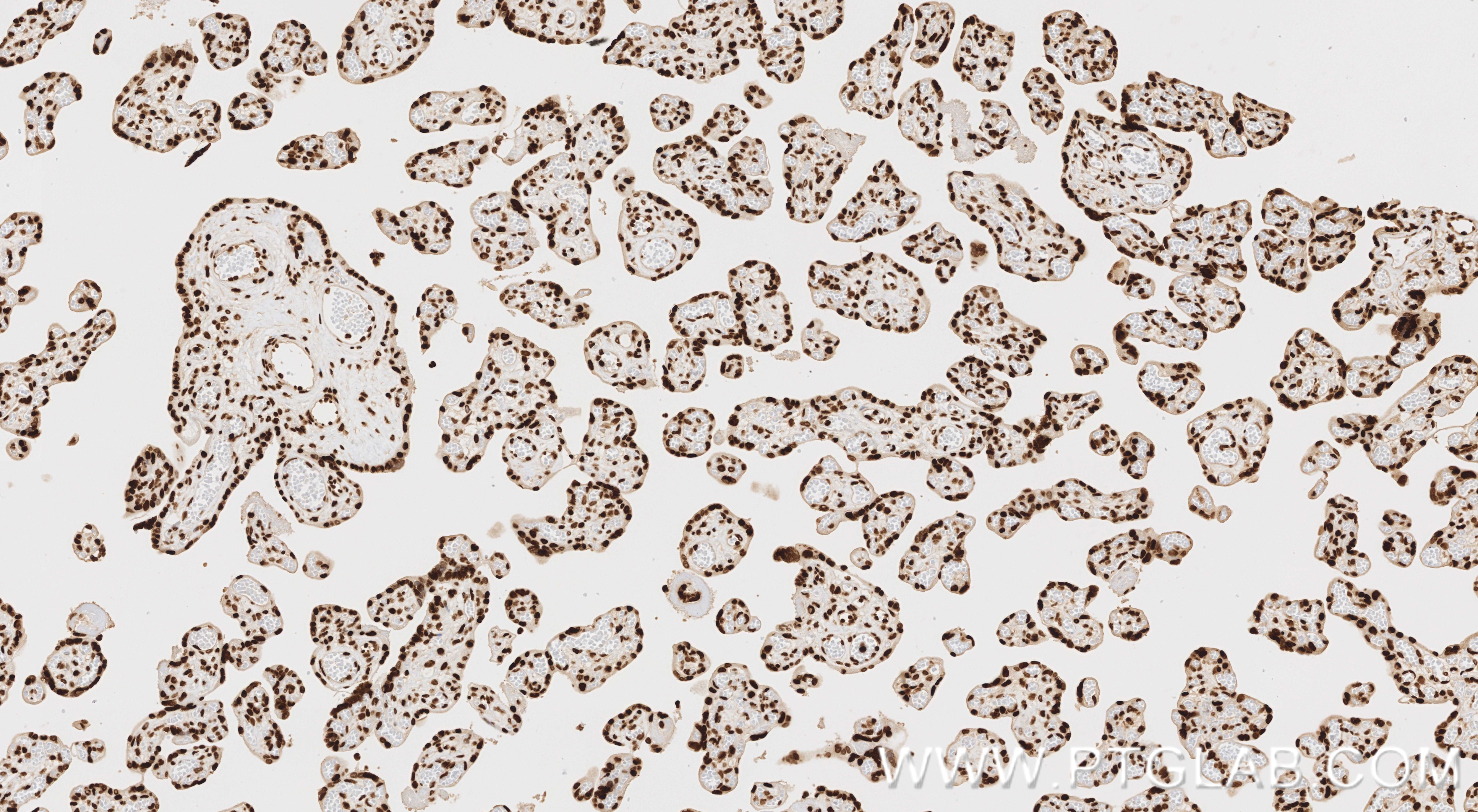IHC staining of human placenta using 86731-1-RR (same clone as 86731-1-PBS) Immunohistochemistry (IHC) staining of human placenta tissue using Acetyl-Histone H2B (Lys12) Recombinant monoclonal (86731-1-RR)
