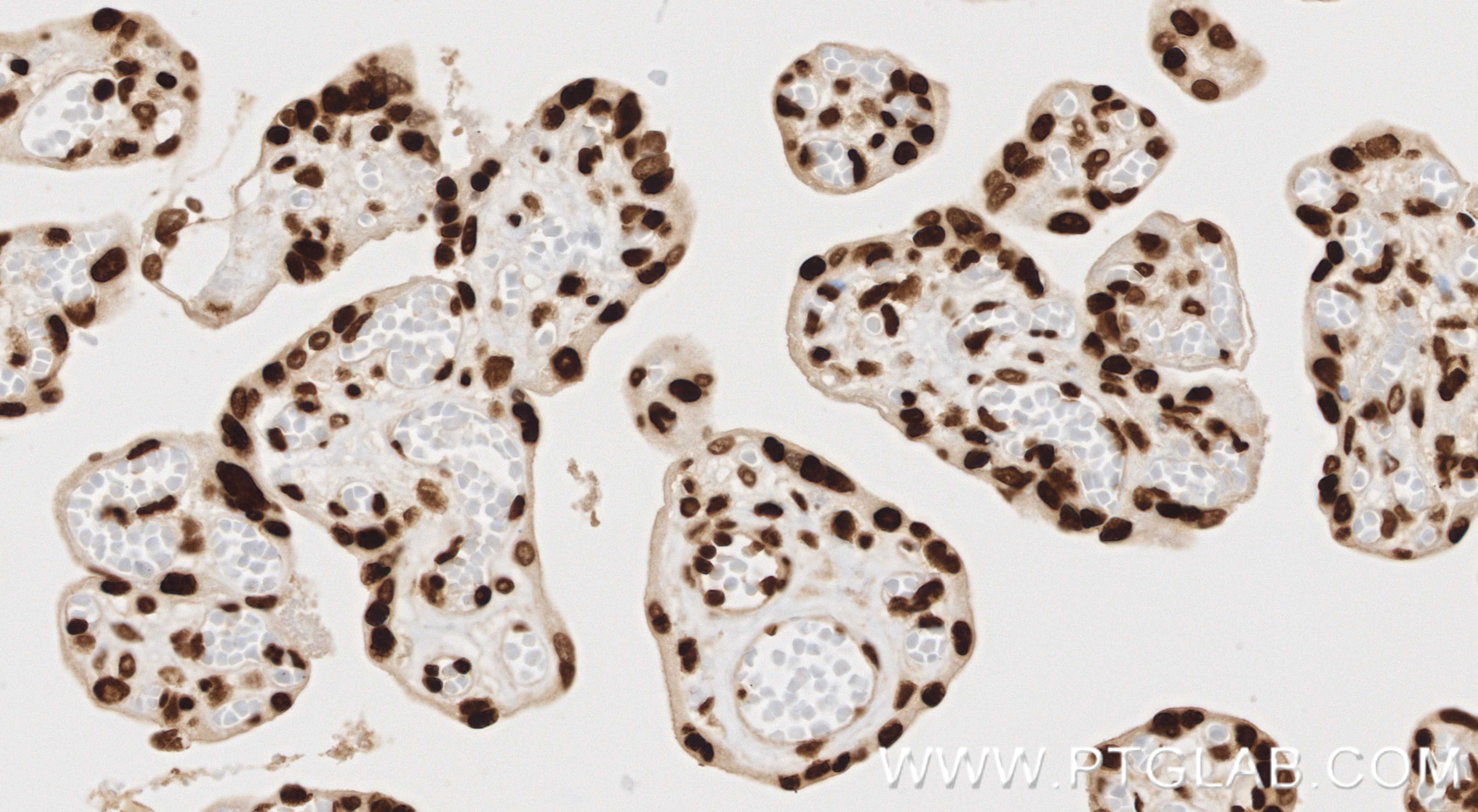 IHC staining of human placenta using 86731-1-RR (same clone as 86731-1-PBS) Immunohistochemistry (IHC) staining of human placenta tissue using Acetyl-Histone H2B (Lys12) Recombinant monoclonal (86731-1-RR)